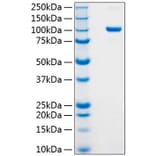 SDS-PAGE - Recombinant Human Argonaute 2 Protein (N-terminal His Tag) (A330121) - Antibodies.com