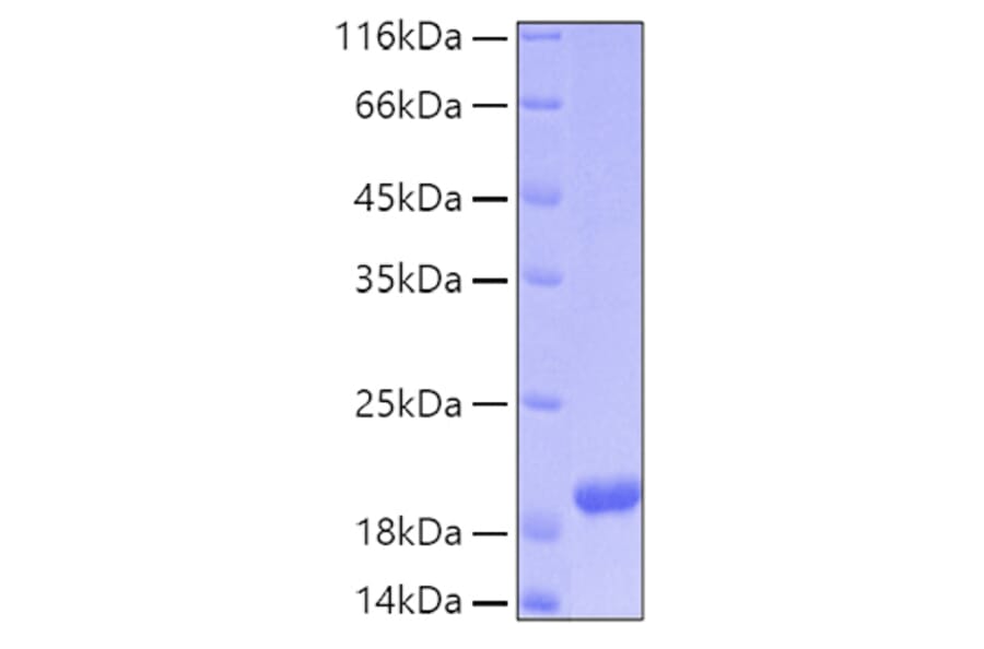 SDS-PAGE - Recombinant Human ARMET Protein (C-terminal His Tag) (A330122) - Antibodies.com