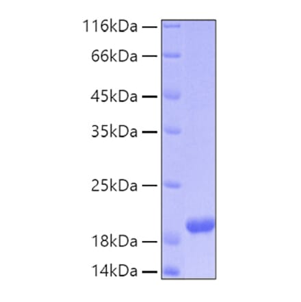 SDS-PAGE - Recombinant Human ARMET Protein (C-terminal His Tag) (A330122) - Antibodies.com