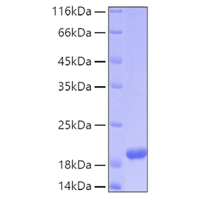 SDS-PAGE - Recombinant Human ARMET Protein (C-terminal His Tag) (A330122) - Antibodies.com
