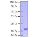 SDS-PAGE - Recombinant Human ARMET Protein (C-terminal His Tag) (A330122) - Antibodies.com