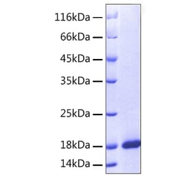 SDS-PAGE - Recombinant Human ARMET Protein (A330123) - Antibodies.com