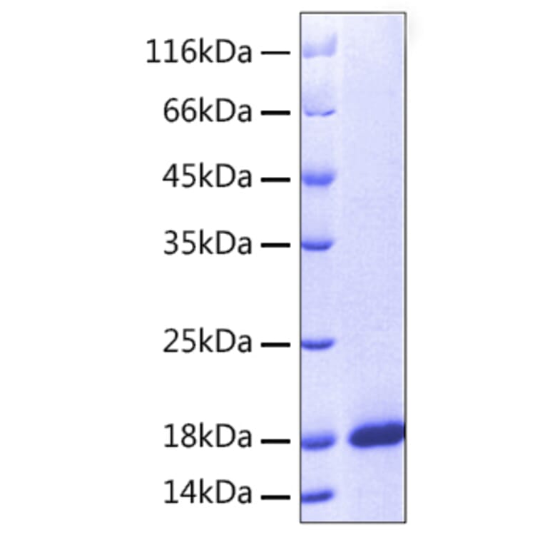 SDS-PAGE - Recombinant Human ARMET Protein (A330123) - Antibodies.com
