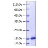 SDS-PAGE - Recombinant Human ARMET Protein (A330123) - Antibodies.com