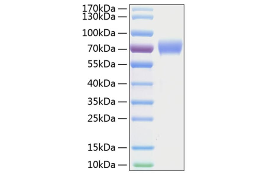 SDS-PAGE - Recombinant Human Axl Protein (C-terminal His Tag) (A330124) - Antibodies.com