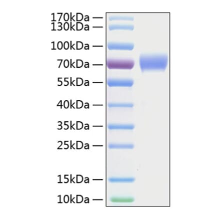 SDS-PAGE - Recombinant Human Axl Protein (C-terminal His Tag) (A330124) - Antibodies.com