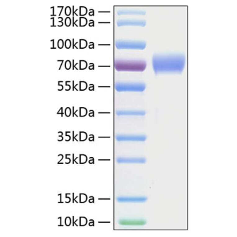 SDS-PAGE - Recombinant Human Axl Protein (C-terminal His Tag) (A330124) - Antibodies.com