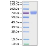 SDS-PAGE - Recombinant Human Axl Protein (C-terminal His Tag) (A330124) - Antibodies.com
