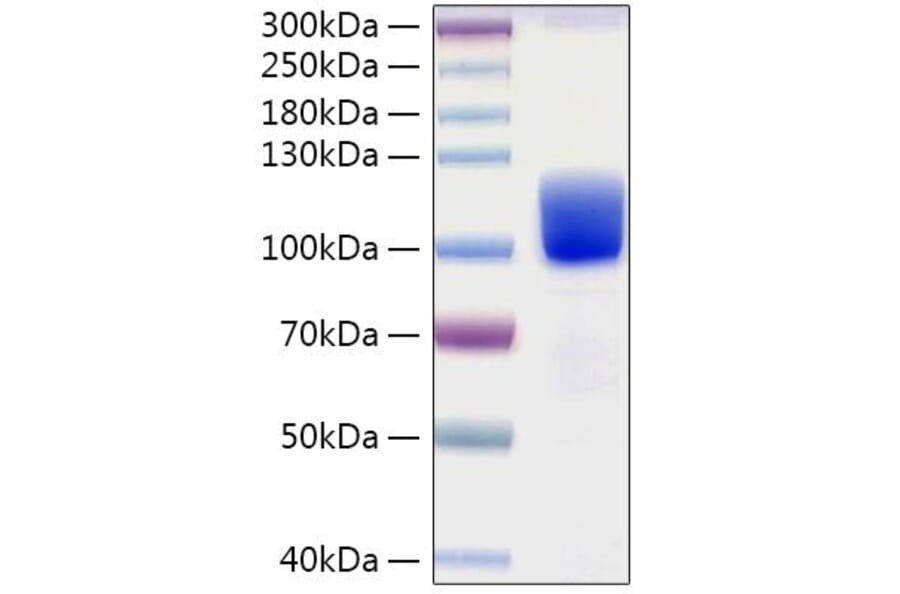 SDS-PAGE - Recombinant Human Axl Protein (C-terminal Human Fc and His Tag) (A330125) - Antibodies.com