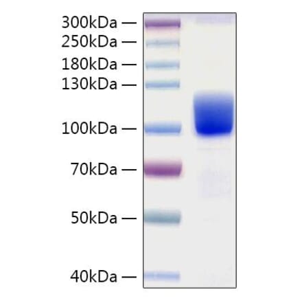 SDS-PAGE - Recombinant Human Axl Protein (C-terminal Human Fc and His Tag) (A330125) - Antibodies.com