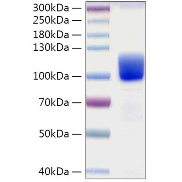 SDS-PAGE - Recombinant Human Axl Protein (C-terminal Human Fc and His Tag) (A330125) - Antibodies.com