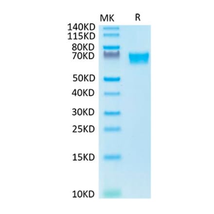 Tris-Bis PAGE - Recombinant Human Axl Protein (Biotin) (C-terminal His and Avi Tag) (A330126) - Antibodies.com