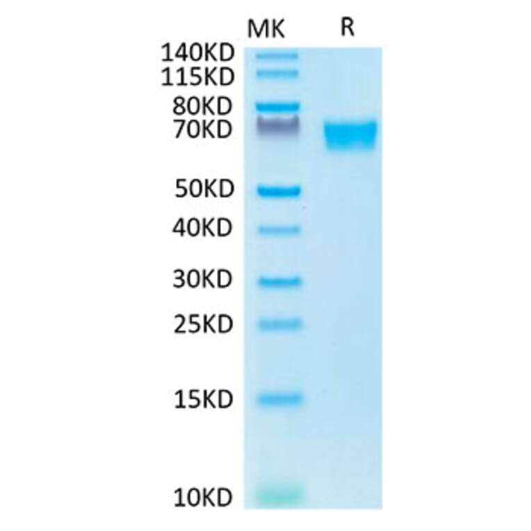 Tris-Bis PAGE - Recombinant Human Axl Protein (Biotin) (C-terminal His and Avi Tag) (A330126) - Antibodies.com