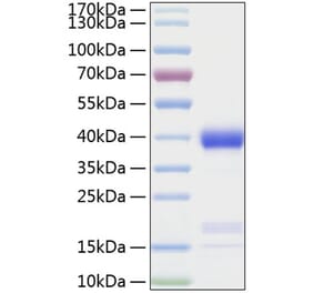 SDS-PAGE - Recombinant Human Azurocidin Protein (C-terminal His Tag) (A330127) - Antibodies.com