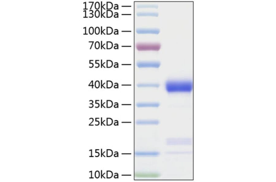 SDS-PAGE - Recombinant Human Azurocidin Protein (C-terminal His Tag) (A330127) - Antibodies.com
