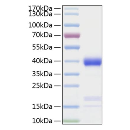 SDS-PAGE - Recombinant Human Azurocidin Protein (C-terminal His Tag) (A330127) - Antibodies.com
