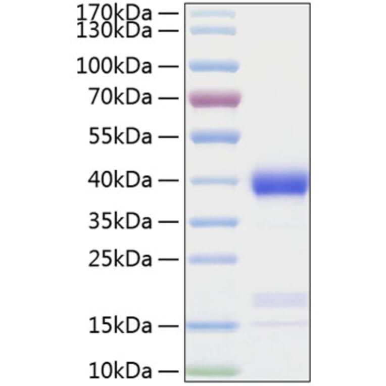 SDS-PAGE - Recombinant Human Azurocidin Protein (C-terminal His Tag) (A330127) - Antibodies.com