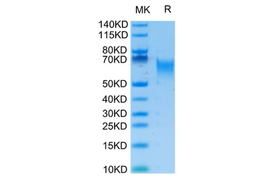 Tris-Bis PAGE - Recombinant Human B7-H2 Protein (Biotin) (C-terminal His and Avi Tag) (A330128) - Antibodies.com