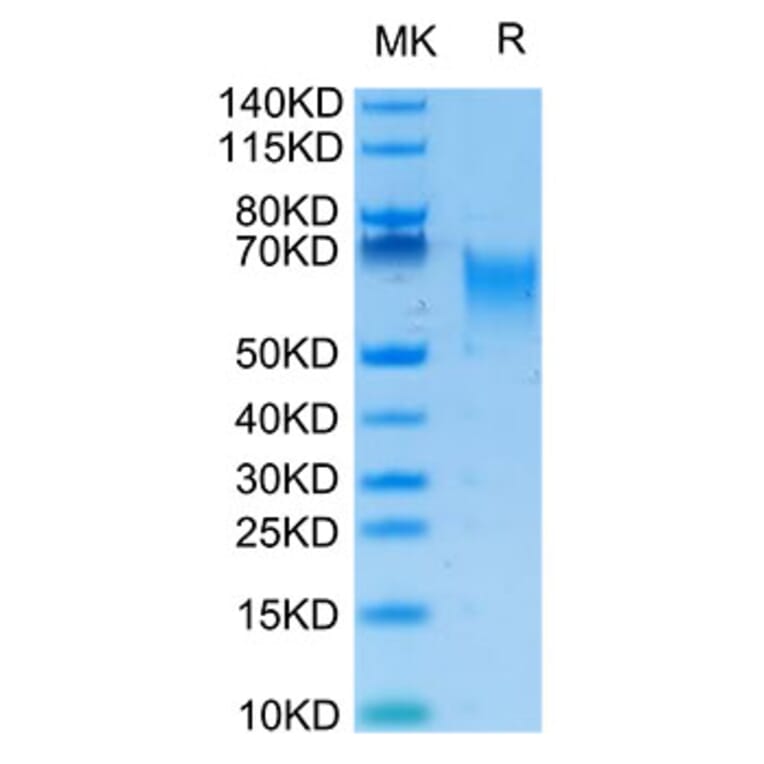 Tris-Bis PAGE - Recombinant Human B7-H2 Protein (Biotin) (C-terminal His and Avi Tag) (A330128) - Antibodies.com