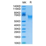 Tris-Bis PAGE - Recombinant Human B7-H2 Protein (Biotin) (C-terminal His and Avi Tag) (A330128) - Antibodies.com