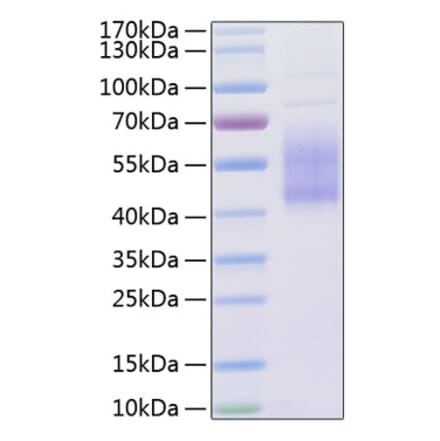 SDS-PAGE - Recombinant Human B7-H2 Protein (C-terminal His Tag) (A330130) - Antibodies.com