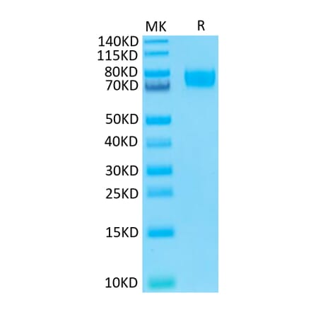 Tris-Bis PAGE - Recombinant Human B7-H3 Protein (Biotin) (C-terminal His and Avi Tag) (A330131) - Antibodies.com