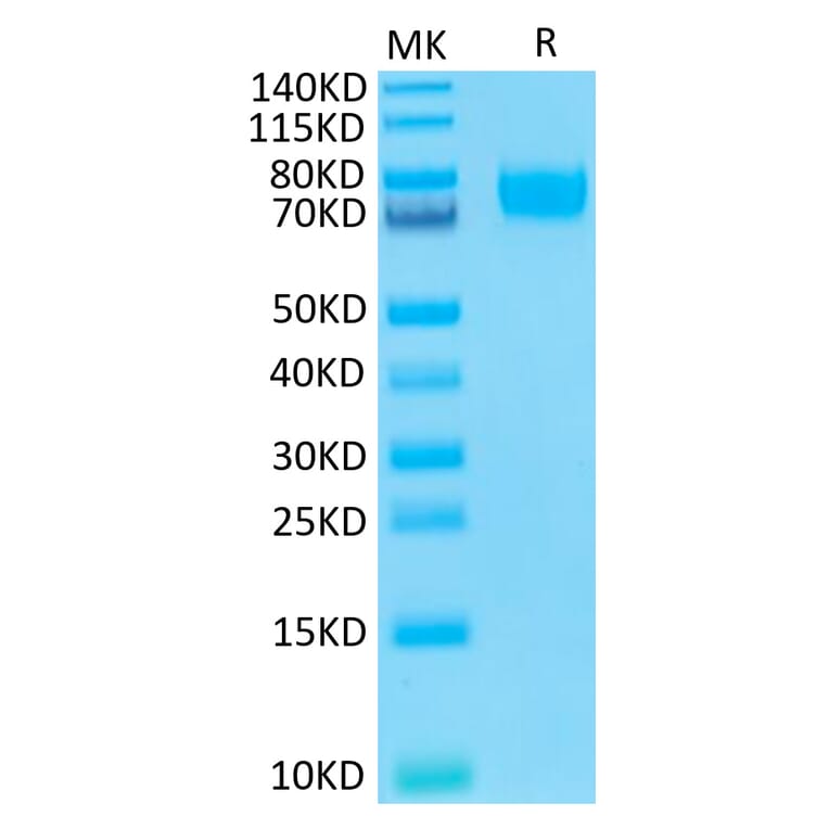 Tris-Bis PAGE - Recombinant Human B7-H3 Protein (Biotin) (C-terminal His and Avi Tag) (A330131) - Antibodies.com