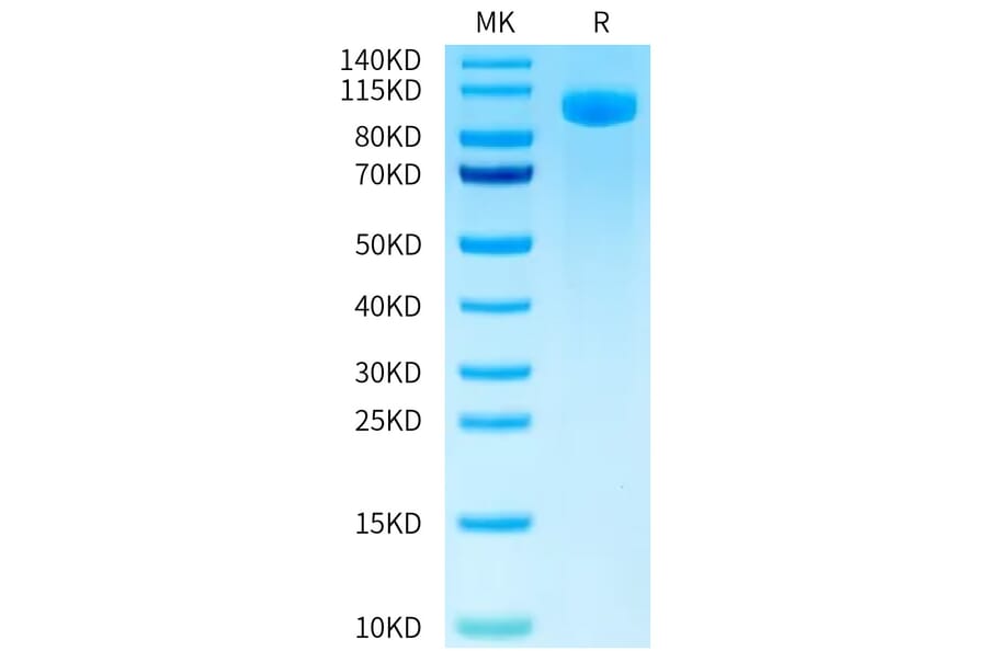 Tris-Bis PAGE - Recombinant Human B7-H3 Protein (FITC) (C-terminal Human Fc Tag) (A330132) - Antibodies.com