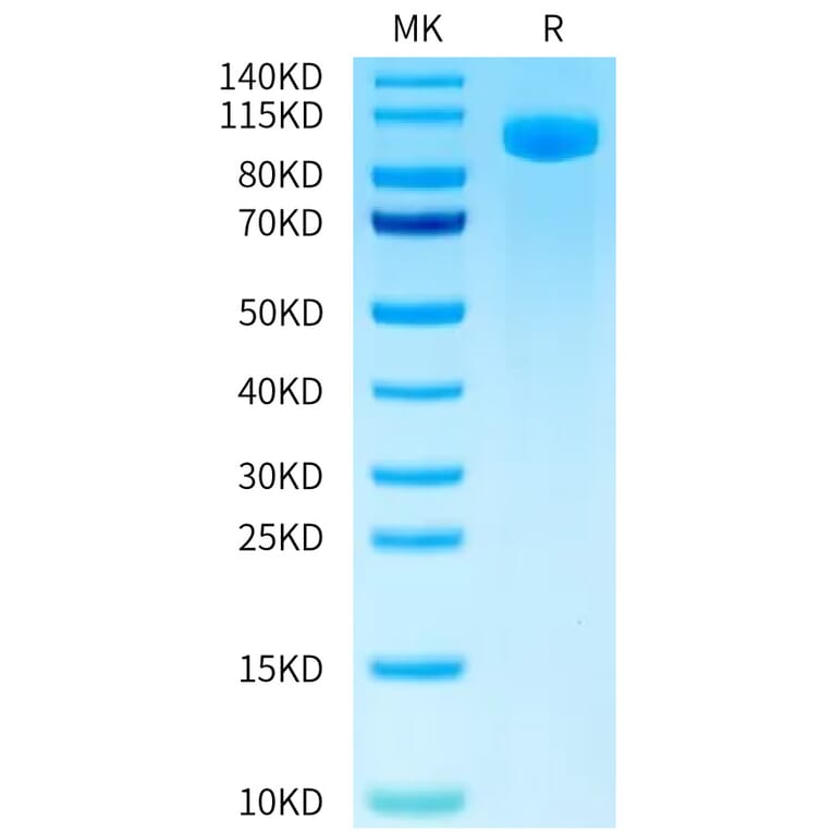 Tris-Bis PAGE - Recombinant Human B7-H3 Protein (FITC) (C-terminal Human Fc Tag) (A330132) - Antibodies.com
