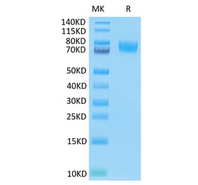 Tris-Bis PAGE - Recombinant Human B7-H3 Protein (C-terminal His and Avi Tag) (A330133) - Antibodies.com