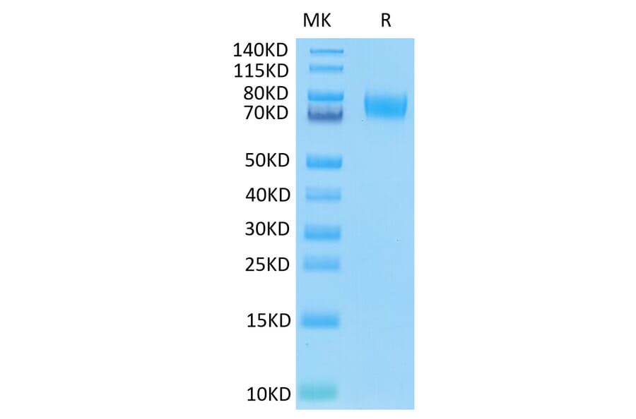 Tris-Bis PAGE - Recombinant Human B7-H3 Protein (C-terminal His and Avi Tag) (A330133) - Antibodies.com