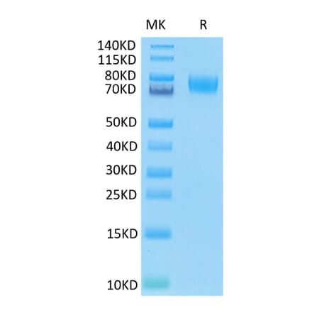Tris-Bis PAGE - Recombinant Human B7-H3 Protein (C-terminal His and Avi Tag) (A330133) - Antibodies.com