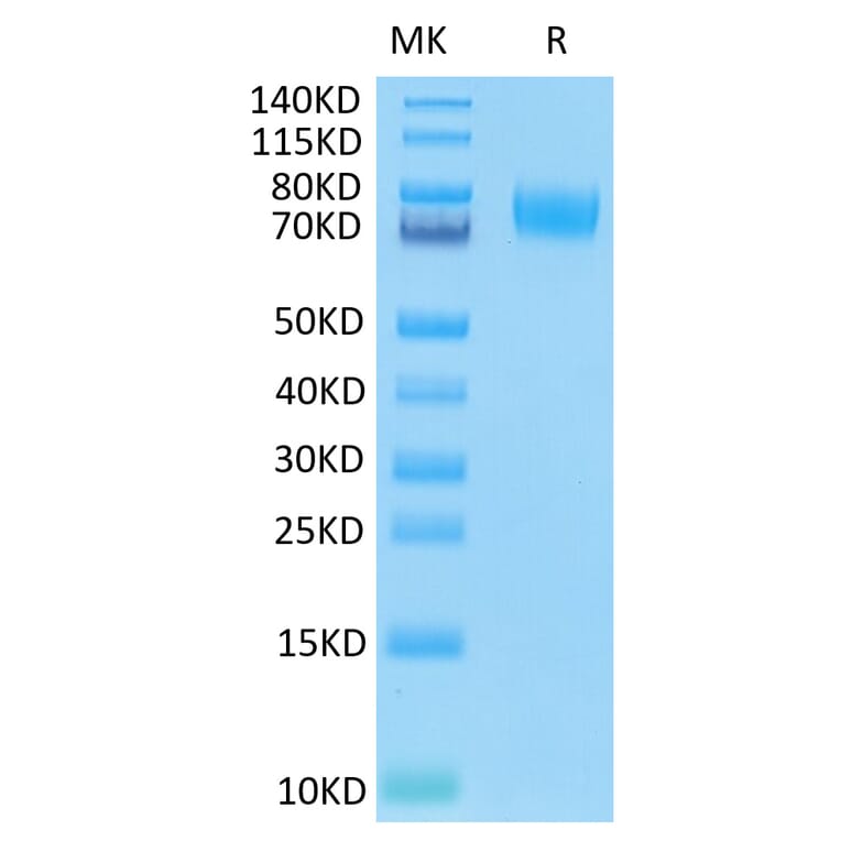 Tris-Bis PAGE - Recombinant Human B7-H3 Protein (C-terminal His and Avi Tag) (A330133) - Antibodies.com