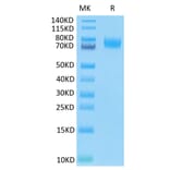 Tris-Bis PAGE - Recombinant Human B7-H3 Protein (C-terminal His and Avi Tag) (A330133) - Antibodies.com