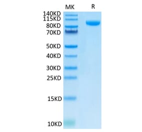 Tris-Bis PAGE - Recombinant Human B7-H3 Protein (C-terminal Human Fc Tag) (A330134) - Antibodies.com