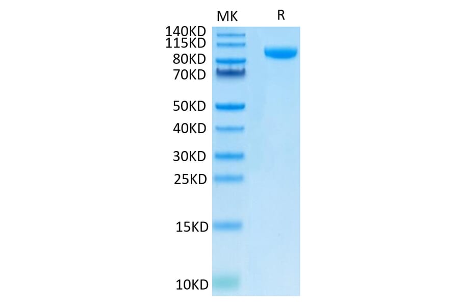 Tris-Bis PAGE - Recombinant Human B7-H3 Protein (C-terminal Human Fc Tag) (A330134) - Antibodies.com