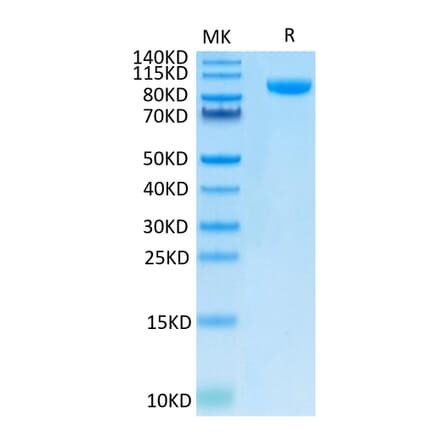 Tris-Bis PAGE - Recombinant Human B7-H3 Protein (C-terminal Human Fc Tag) (A330134) - Antibodies.com