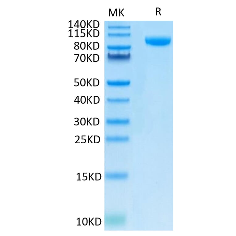 Tris-Bis PAGE - Recombinant Human B7-H3 Protein (C-terminal Human Fc Tag) (A330134) - Antibodies.com