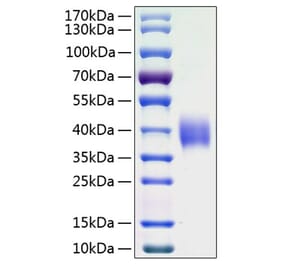 SDS-PAGE - Recombinant Human B7-H3 Protein (C-terminal His Tag) (A330135) - Antibodies.com