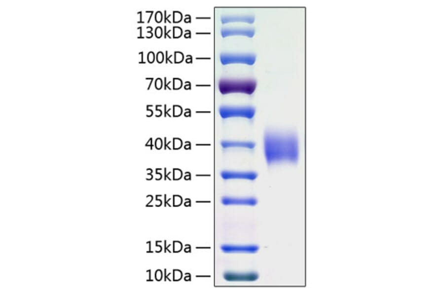 SDS-PAGE - Recombinant Human B7-H3 Protein (C-terminal His Tag) (A330135) - Antibodies.com