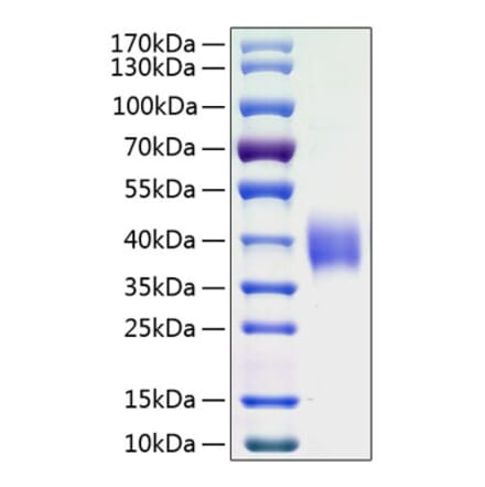 SDS-PAGE - Recombinant Human B7-H3 Protein (C-terminal His Tag) (A330135) - Antibodies.com