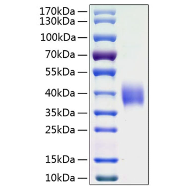 SDS-PAGE - Recombinant Human B7-H3 Protein (C-terminal His Tag) (A330135) - Antibodies.com