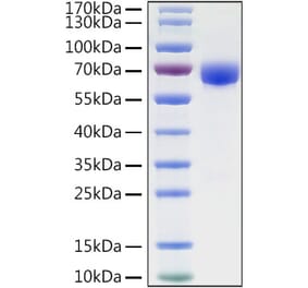 SDS-PAGE - Recombinant Human B7-H3 Protein (C-terminal Human Fc and His Tag) (A330136) - Antibodies.com