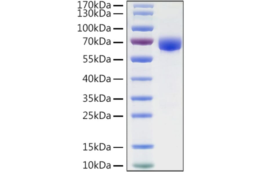 SDS-PAGE - Recombinant Human B7-H3 Protein (C-terminal Human Fc and His Tag) (A330136) - Antibodies.com