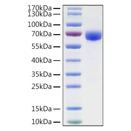 SDS-PAGE - Recombinant Human B7-H3 Protein (C-terminal Human Fc and His Tag) (A330136) - Antibodies.com