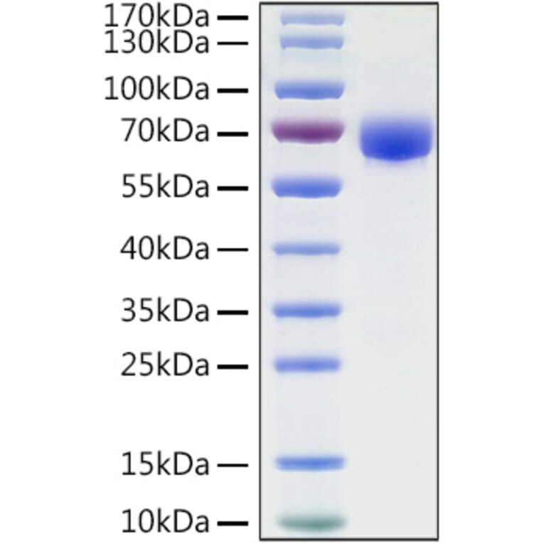 SDS-PAGE - Recombinant Human B7-H3 Protein (C-terminal Human Fc and His Tag) (A330136) - Antibodies.com