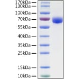 SDS-PAGE - Recombinant Human B7-H3 Protein (C-terminal Human Fc and His Tag) (A330136) - Antibodies.com