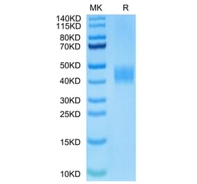Tris-Bis PAGE - Recombinant Human B7-H3 Protein (Biotin) (C-terminal His and Avi Tag) (A330137) - Antibodies.com