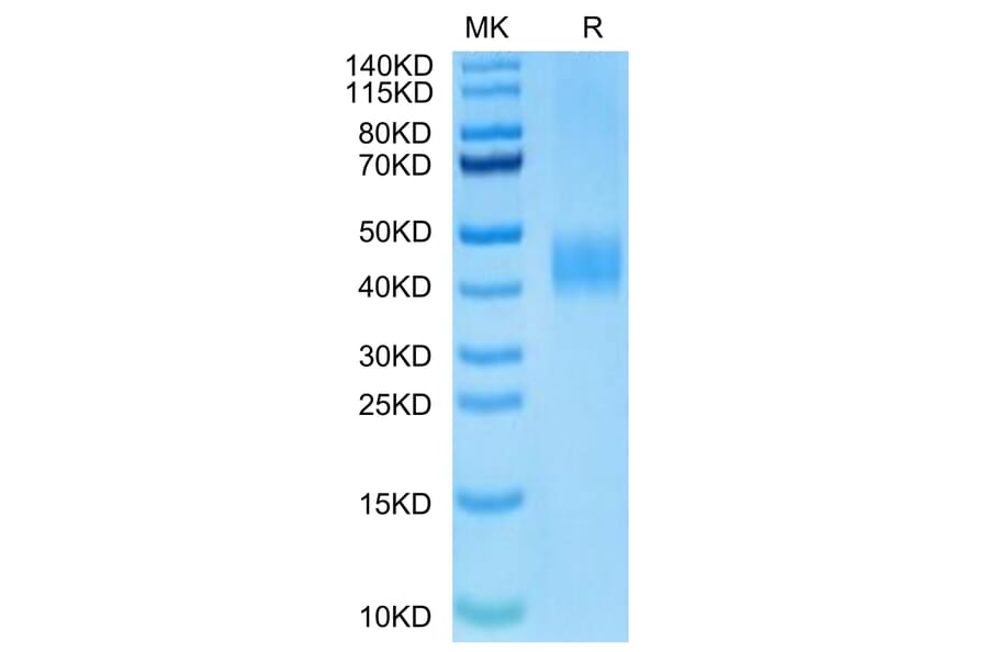 Tris-Bis PAGE - Recombinant Human B7-H3 Protein (Biotin) (C-terminal His and Avi Tag) (A330137) - Antibodies.com