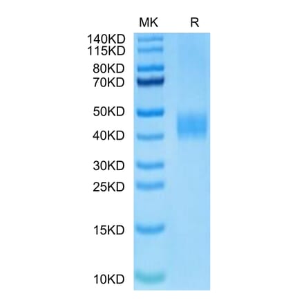 Tris-Bis PAGE - Recombinant Human B7-H3 Protein (Biotin) (C-terminal His and Avi Tag) (A330137) - Antibodies.com